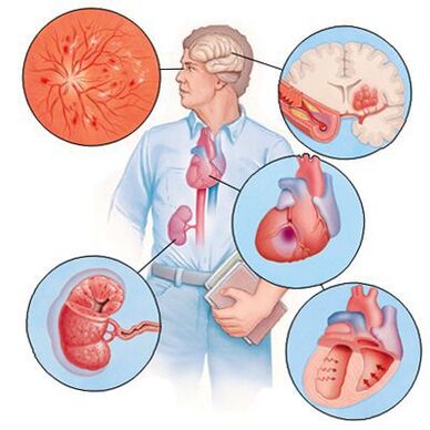 Cardiol verhindert die Entstehung von Begleiterkrankungen